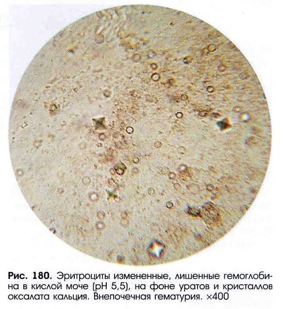 Микроскопия осадка мочи - Фотоальбомы - Сайт преподавателя МКЛИ ...